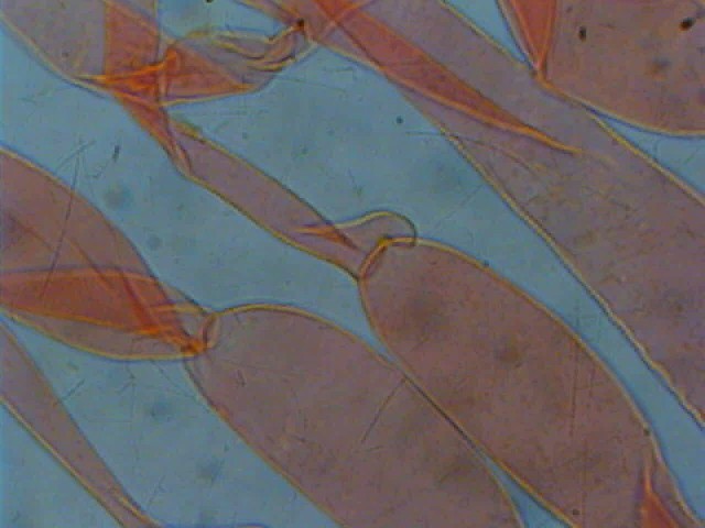 Cortinarius candelaris?